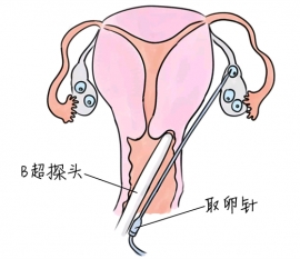 幼儿学画画，沈阳捐卵宝宝学画画，学画画的好处，如何学画画