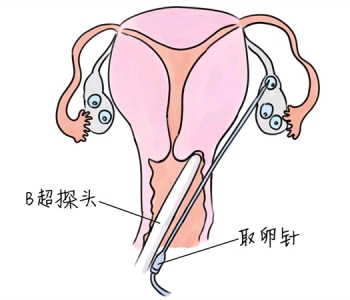 幼儿学画画，沈阳捐卵宝宝学画画，学画画的好处，如何学画画